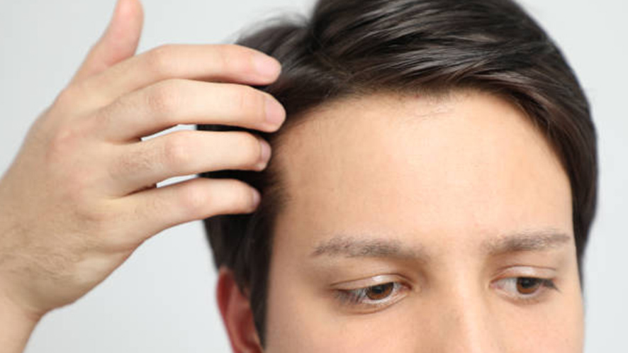 Men's Toupee Types, Care, Costs and More (2)