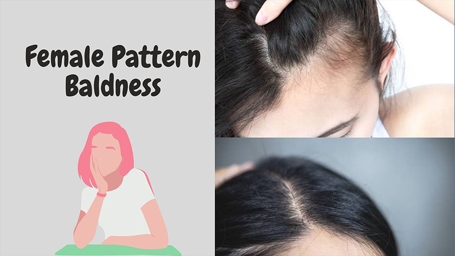 The women's hair loss solution, hair pieces for women for 2021 (7)