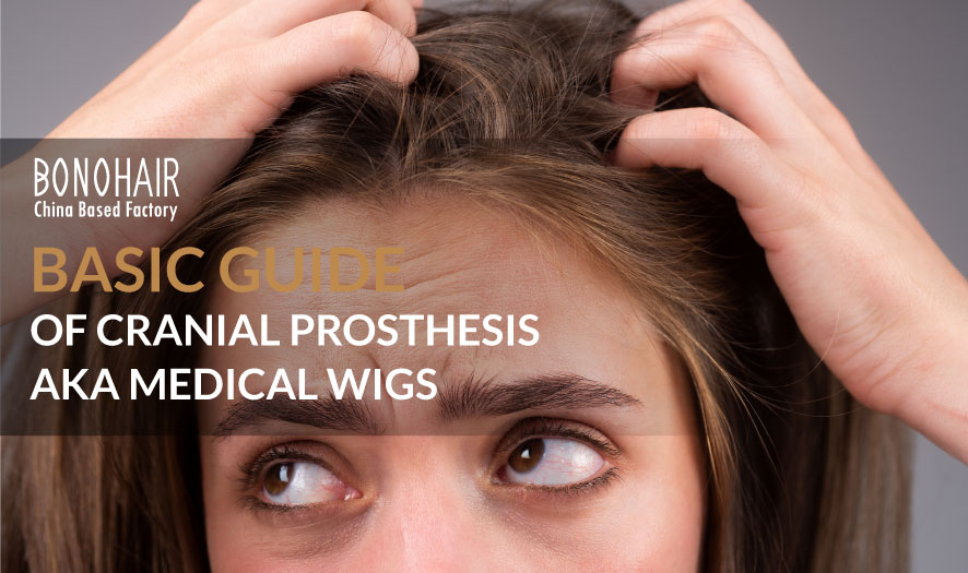 Basic Guide of Cranial Prosthesis aka Medical Wigs (21)
