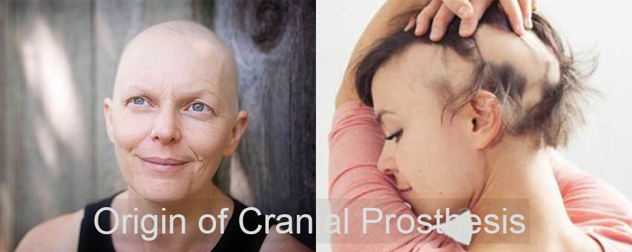 Basic Guide of Cranial Prosthesis aka Medical Wigs (3)