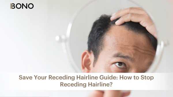 hairline receding (17)