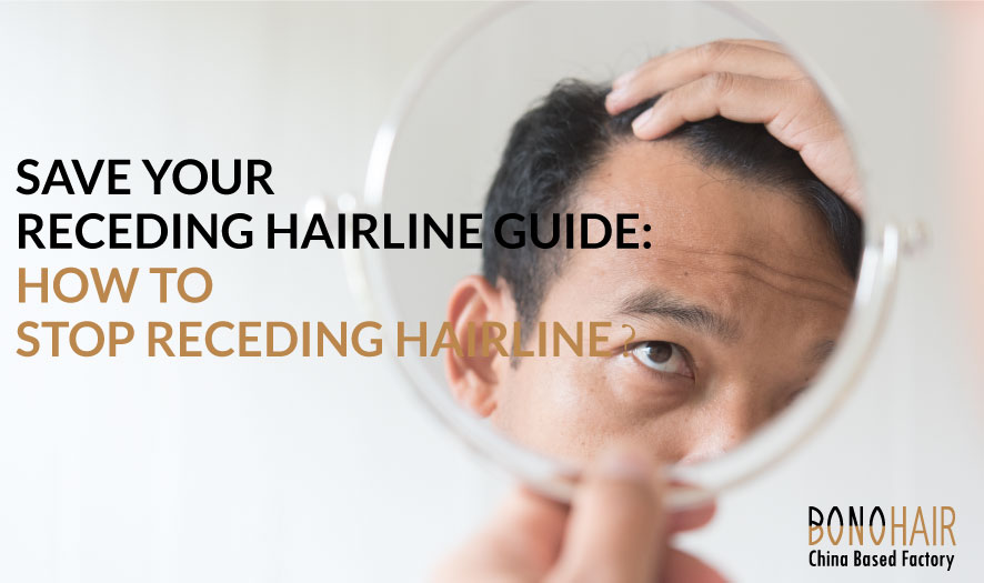 hairline receding (17)