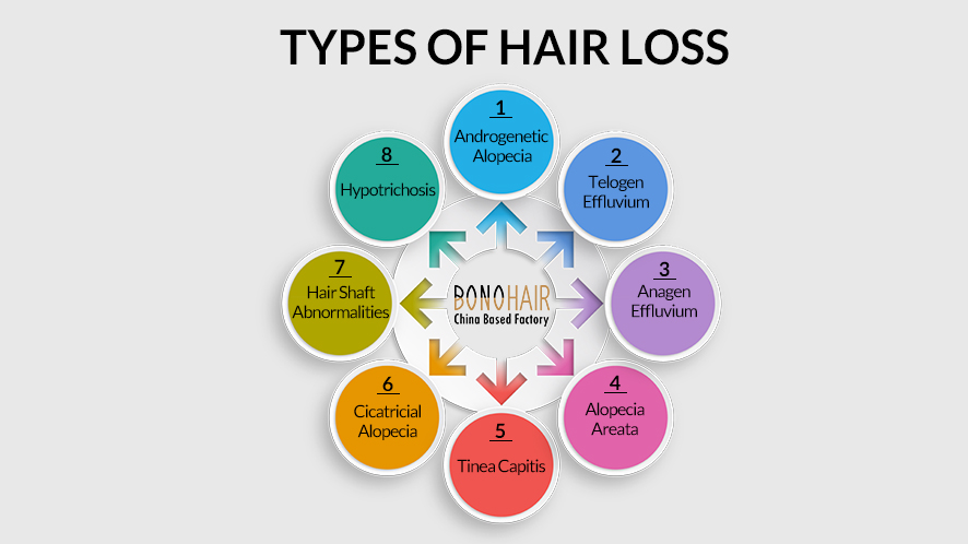 10 causes of hair losses.edited.edited (1)