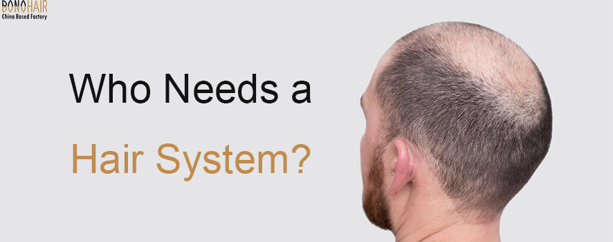 Everything You Need to Know About Hair System (17)