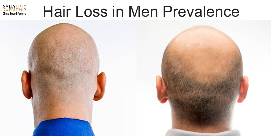 Men’s Hair Regrowth Secrets You Never Knew (20)
