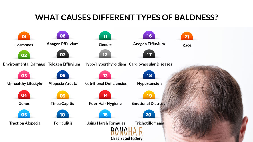 Wondering How to Solve Types of Baldness (1)