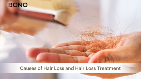 Causes of Hair Loss and Hair Loss Treatment (12)