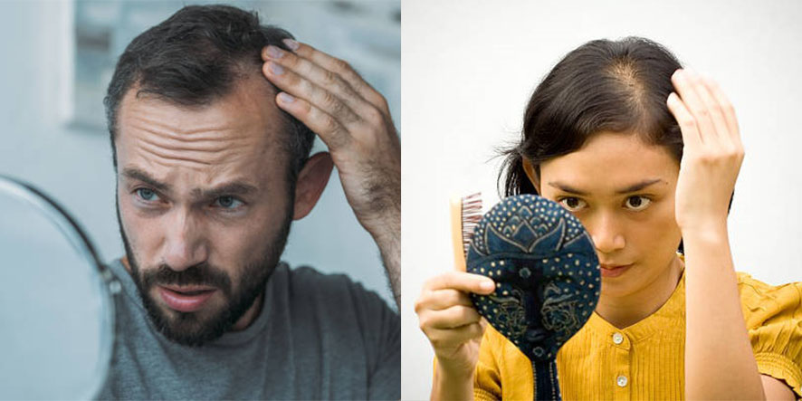 Causes of Hair Loss and Hair Loss Treatment (14)