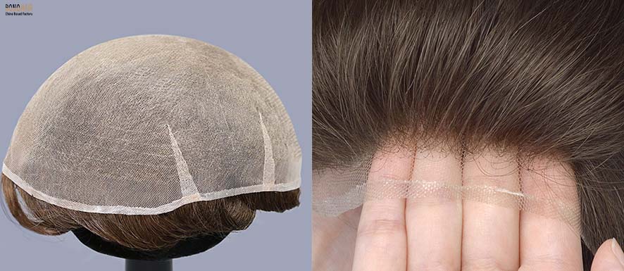 Causes of Hair Loss and Hair Loss Treatment (5)