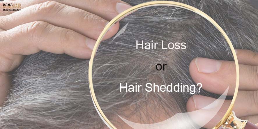 How To Stop Hair Loss (14)