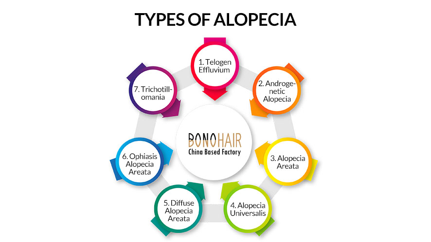 What is Alopecia and Alopecia Treatment (12)