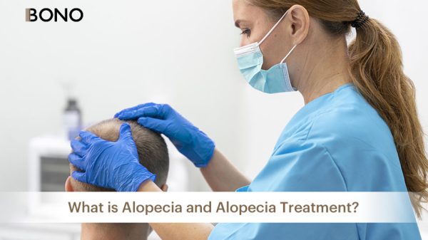 What is Alopecia and Alopecia Treatment (9)