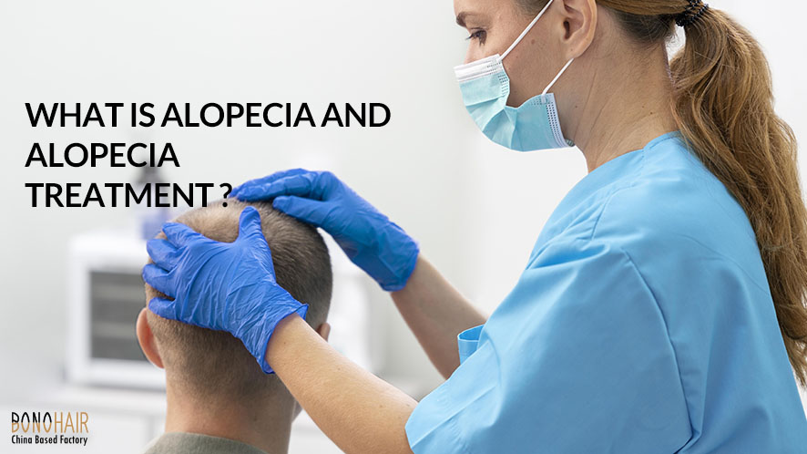 What is Alopecia and Alopecia Treatment (9)