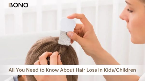 All You Need to Know about Hair Loss in Kids_Children (12)
