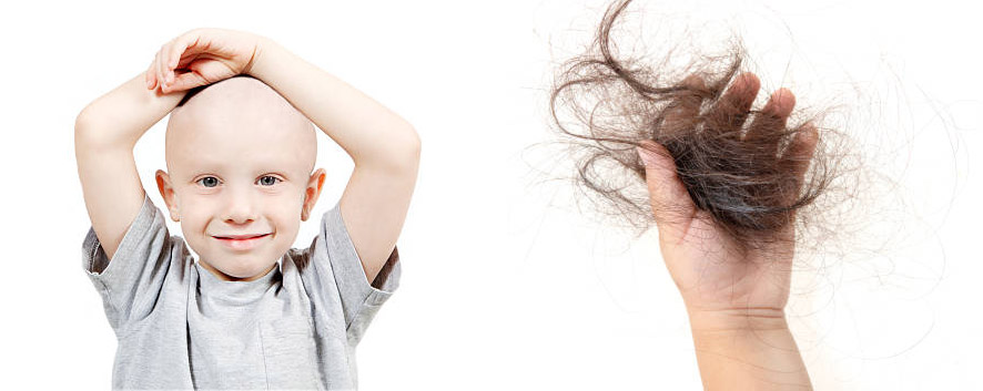All You Need to Know about Hair Loss in Kids_Children (14)