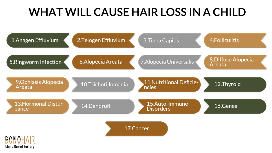 All You Need to Know about Hair Loss in Kids_Children (15)