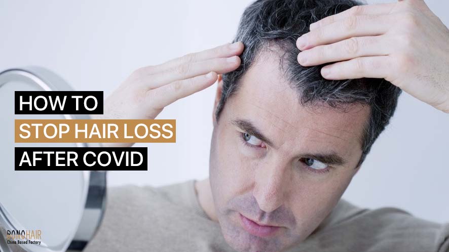 Hair Loss after COVID (5)