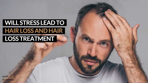 Will Stress Lead to Hair Loss and Hair Loss Treatment (1)
