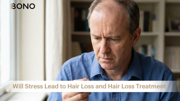 Will Stress Lead to Hair Loss and Hair Loss Treatment (1)