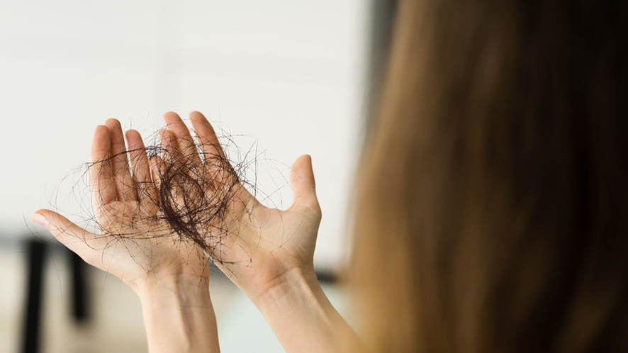 PCOS and Hair Loss_ How To Treat PCOS Hair Loss (1)