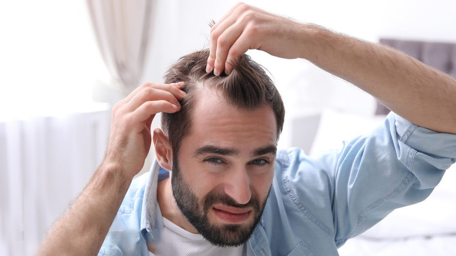 Is Your Hair Loss Normal and How to Treat It (1)