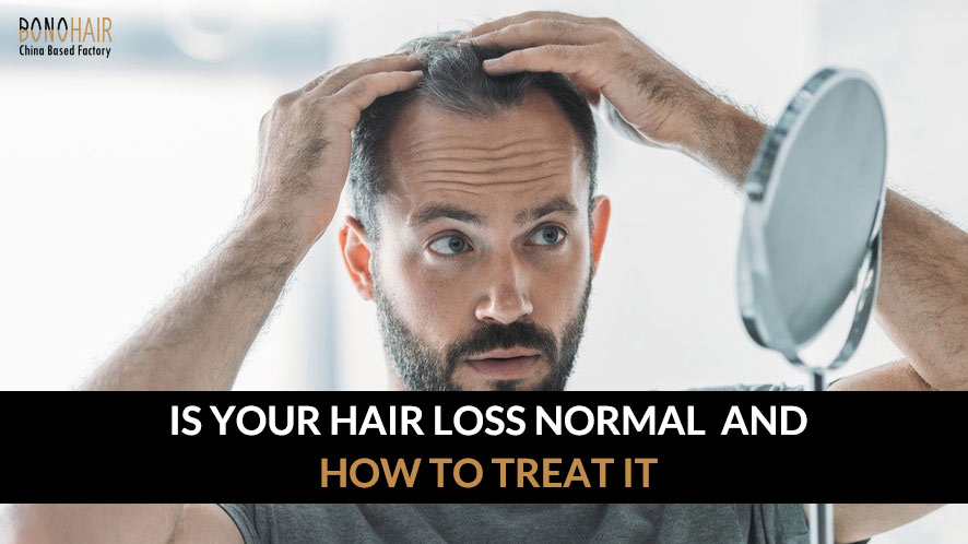 Is Your Hair Loss Normal and How to Treat It (2)