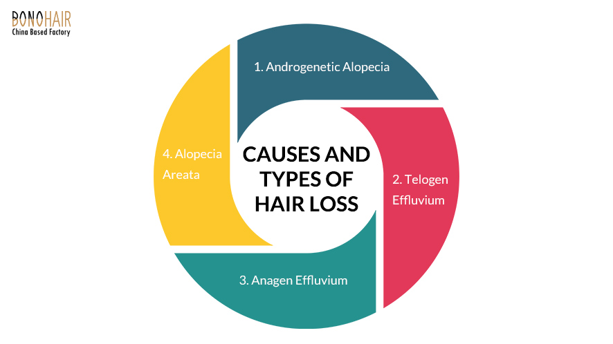 Is Your Hair Loss Normal and How to Treat It (4)