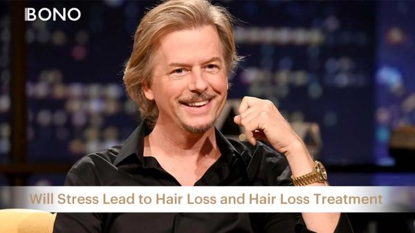 Focusing on David Spade Hair_ Is David Spade Bald (6)