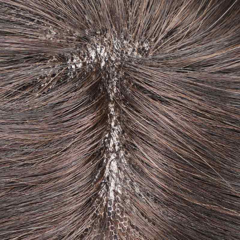 Ex-Australia Skin Lace Hair System Is Poly Around Hair Replacement From Bono Hair