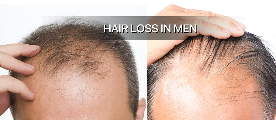 Best Hairstyles For Older Men With Thinning Hair (6)