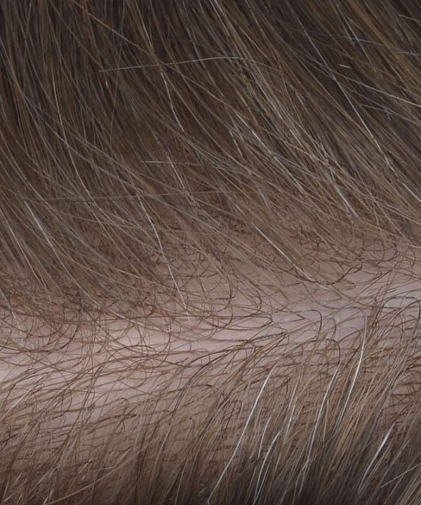 Scallop Front Skin Hair Replacement Is Skin Hair Prosthesis From Bono Hair