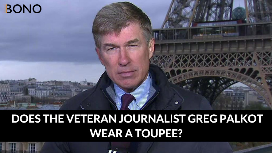 Does The Veteran Journalist Greg Palkot Wear a Toupee (4)