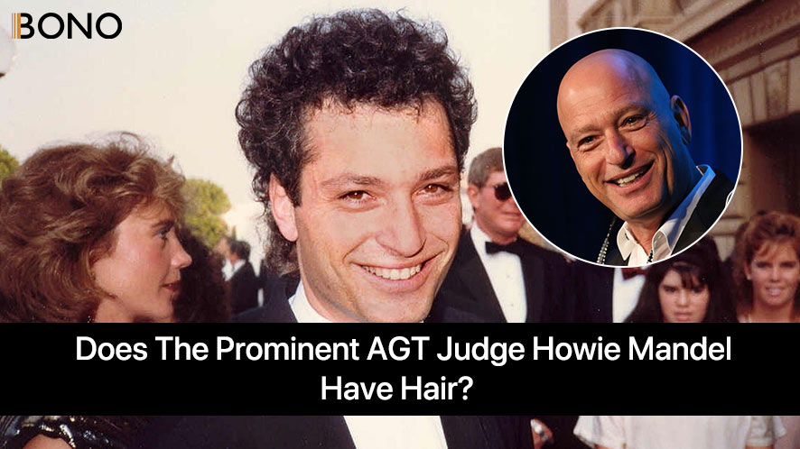 Mystery about Howie Mandel's Hair Loss (3)