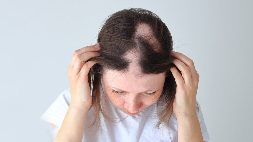 The 10 Best Hair Toppers to Solve the Hair ThinningHair Loss Issue in Women (9)
