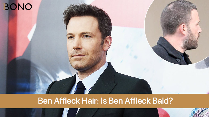 Ben Affleck Hair is Ben Affeck Bald (3)