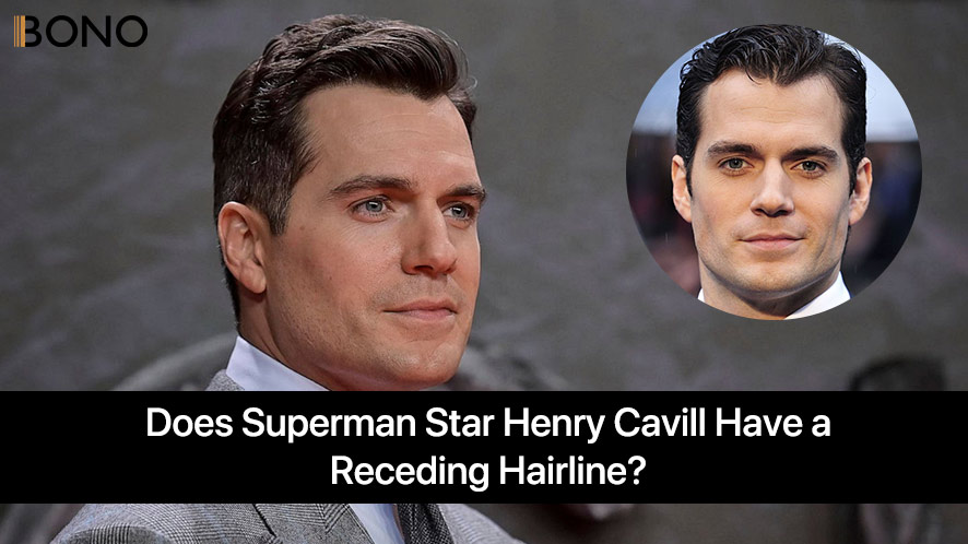 Does Superman star Henry Cavill Have a Receding Hairline (5)