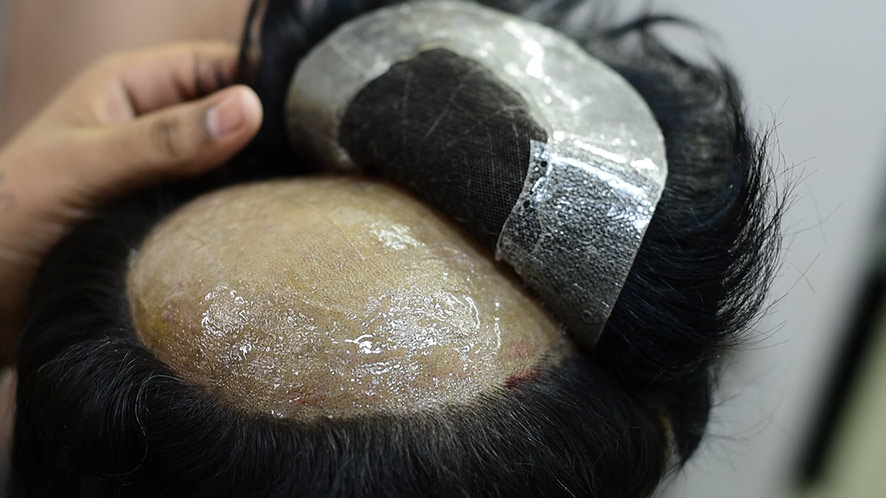 All You Need to Know About Clean-up, Installation, and Removal of Hair Replacement System (5)