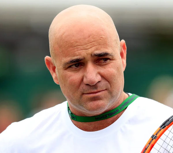 20 Renowned Athletes Who Suffered from Drastic Hair Loss Issues (3)