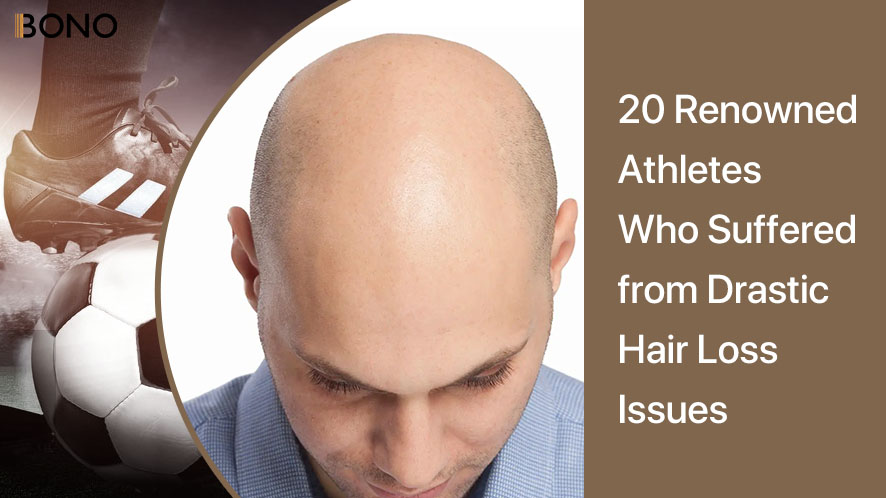 20 Renowned Athletes Who Suffered from Drastic Hair Loss Issues