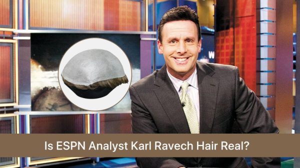 Is ESPN Analyst Karl Ravech Hair Real (2)