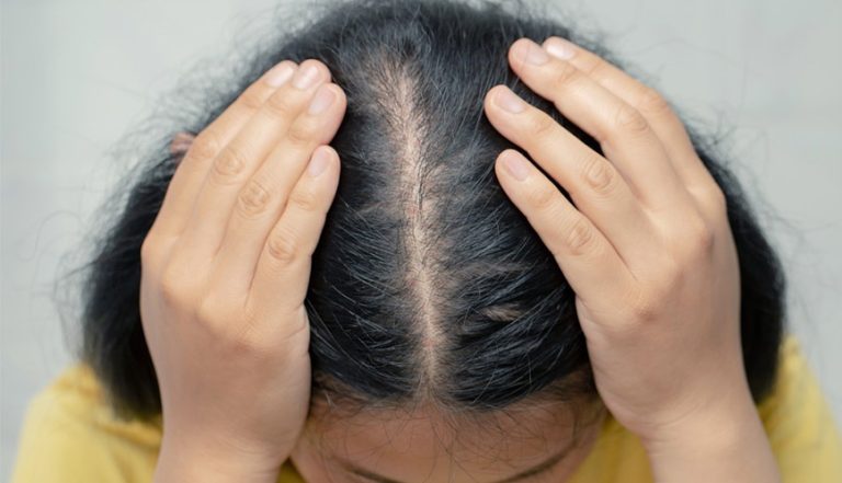 How To Stop Hair From Itching Under Wig