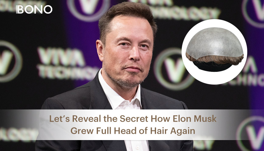 Let’s Reveal the Secret How Elon Musk Grew Full Head of Hair Again