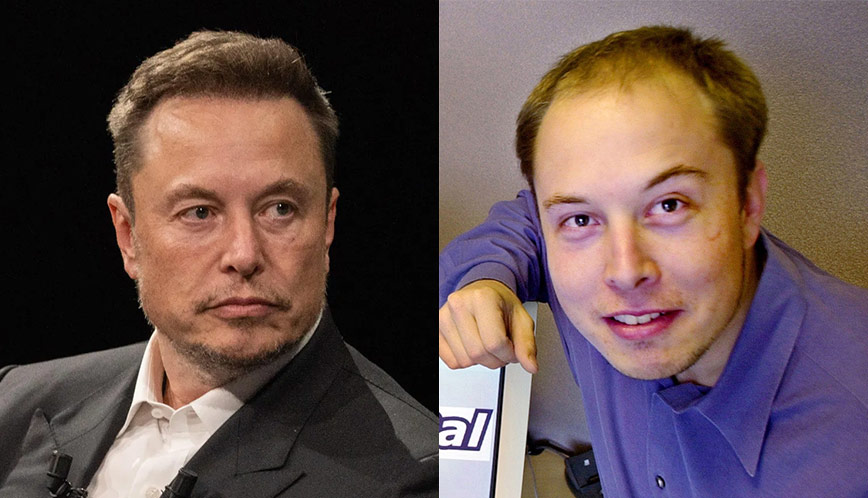 Comparison of Musk's Hair Loss