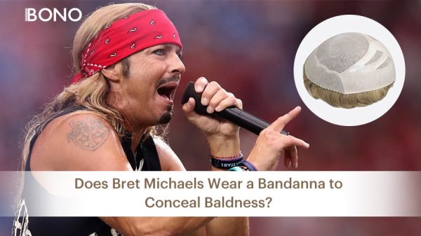 Does Bret Michaels Wear a Bandanna to Conceal Baldness1