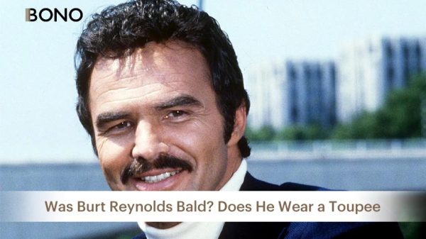1-Was Burt Reynolds Bald Does He Wear a Toupee