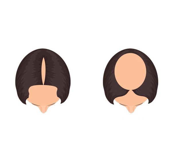7Lace Front vs. Full Lace Wigs Which One Is Right for You