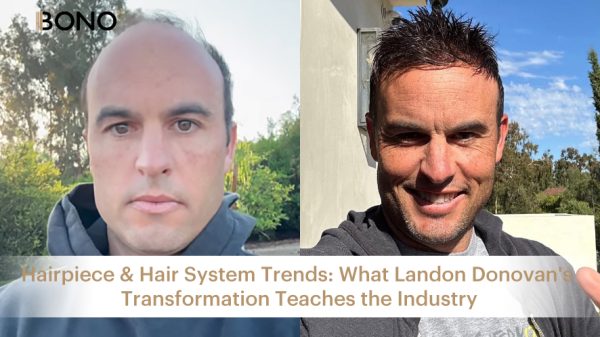 Before and after comparison of Landon Donovan wearing a hairpiece, showcasing his transformation and the natural, realistic look of the hair system.