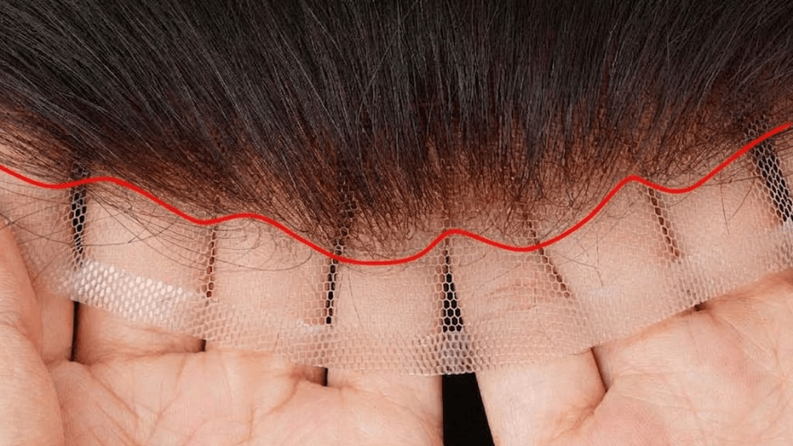 Close-up of a natural hairline of Bono Hair's men's hair system with zigzag hair distribution for a more realistic look