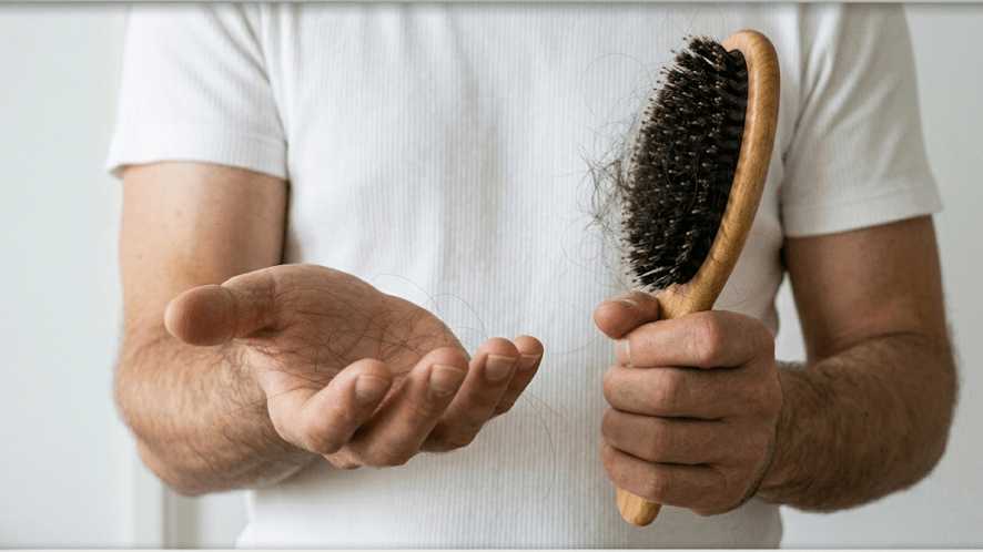 Close-up of a man showing hair fall from a hair system onto his palm and a hairbrush.