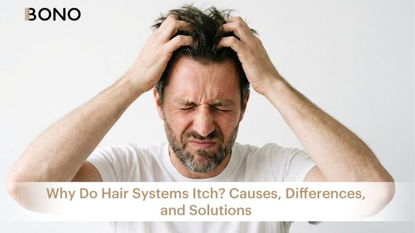 cover-Why Hair Systems Itch Causes, Differences, and Solutions